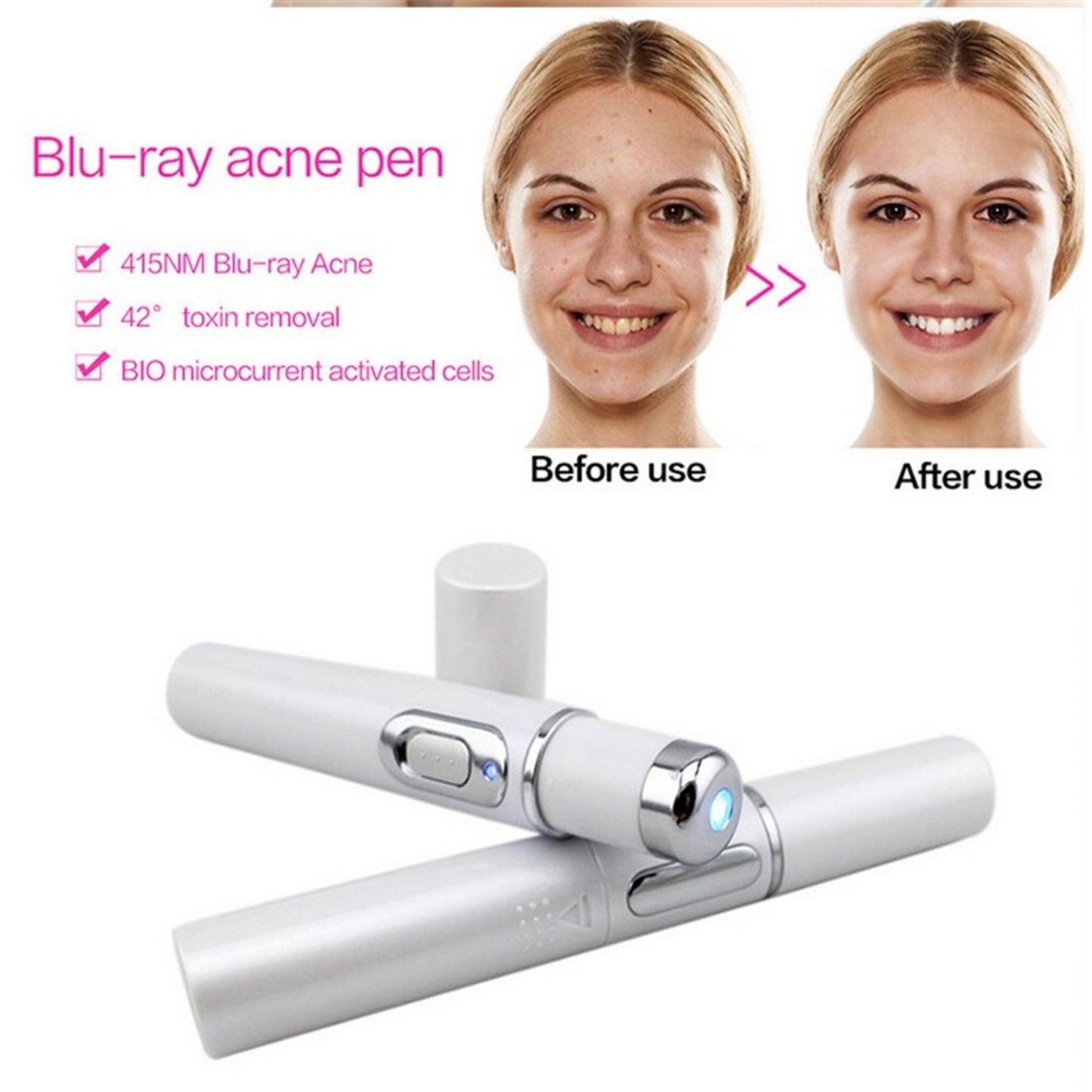 Blue Light Therapy Acne Laser Pen Soft Scar Wrinkle Removal Treatment Device Skin Care Beauty Equipment ARZ