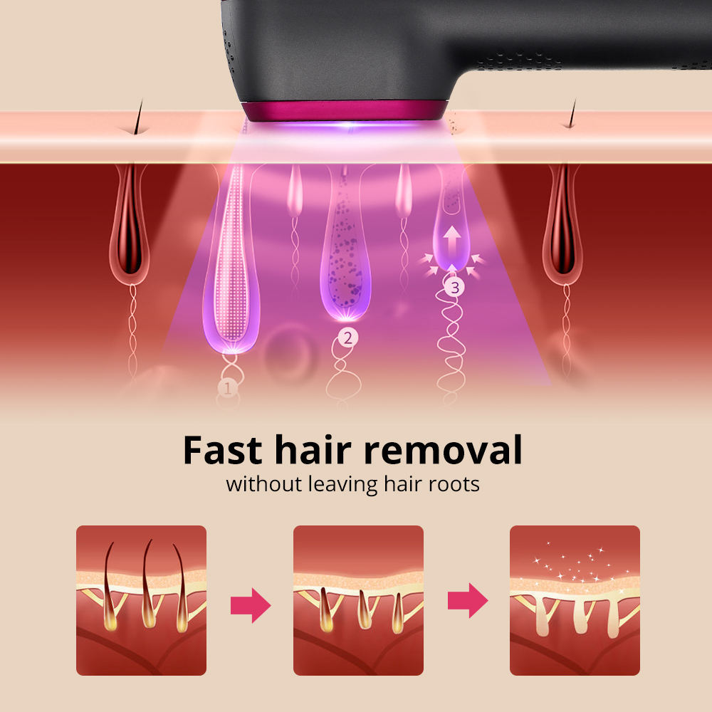 1PCS Laser Hair Removal For Women And Man 100,000 Flashes IPL Painless Laser Hair Removal ARZ