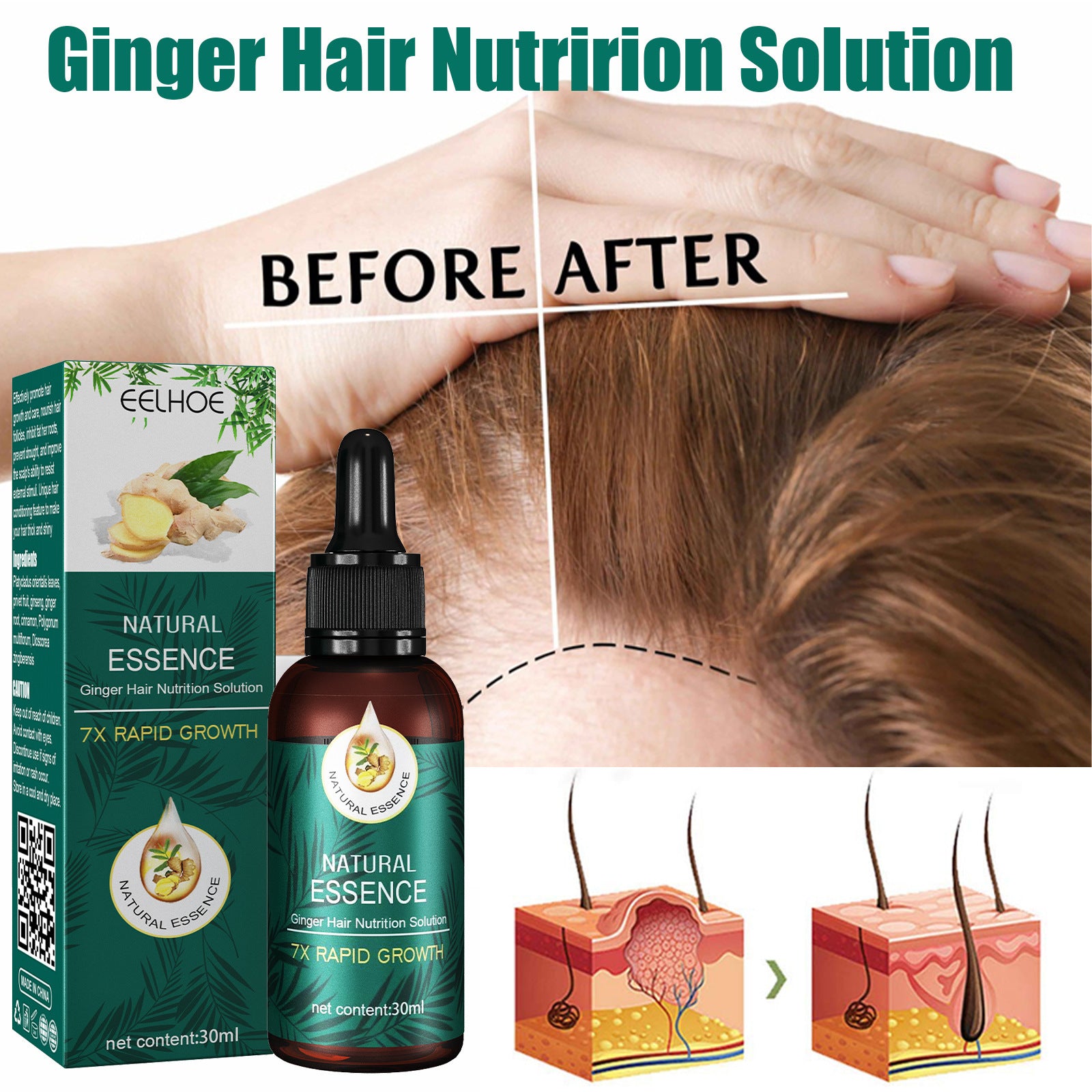 EELHOE Mature Ginger Up Hair Care Essential Oil ARZ