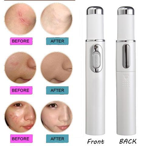 Blue Light Therapy Acne Laser Pen Soft Scar Wrinkle Removal Treatment Device Skin Care Beauty Equipment ARZ